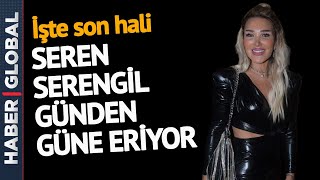 Seren Serengil Hastalığını Açıkladı 4 Santimetre Kısaldı