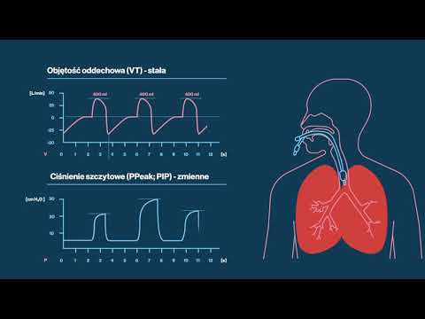 Wideo: Wentylacja Kontrolowana Przepływem (FCV) Poprawia Wentylację Regionalną U Otyłych Pacjentów - Randomizowane Kontrolowane Badanie Krzyżowe