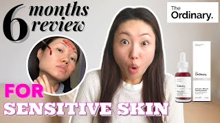 The Ordinary Peeling Solution For Sensitive Skin | 6 Months Honest Review