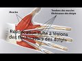 Rducation suite   lsions des tendons flchisseurs des doigts