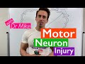 Motor Neuron Injury