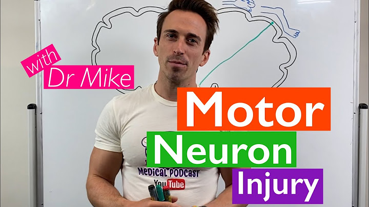 Upper vs lower motor neuron signs