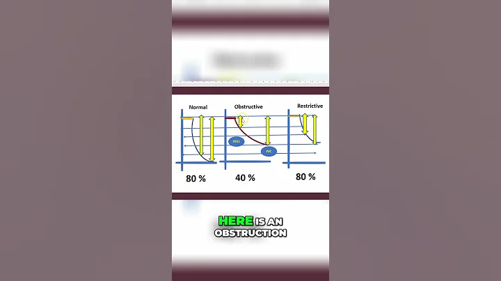 Spirometry FEV1/FVC: Airway Obstruction Explained