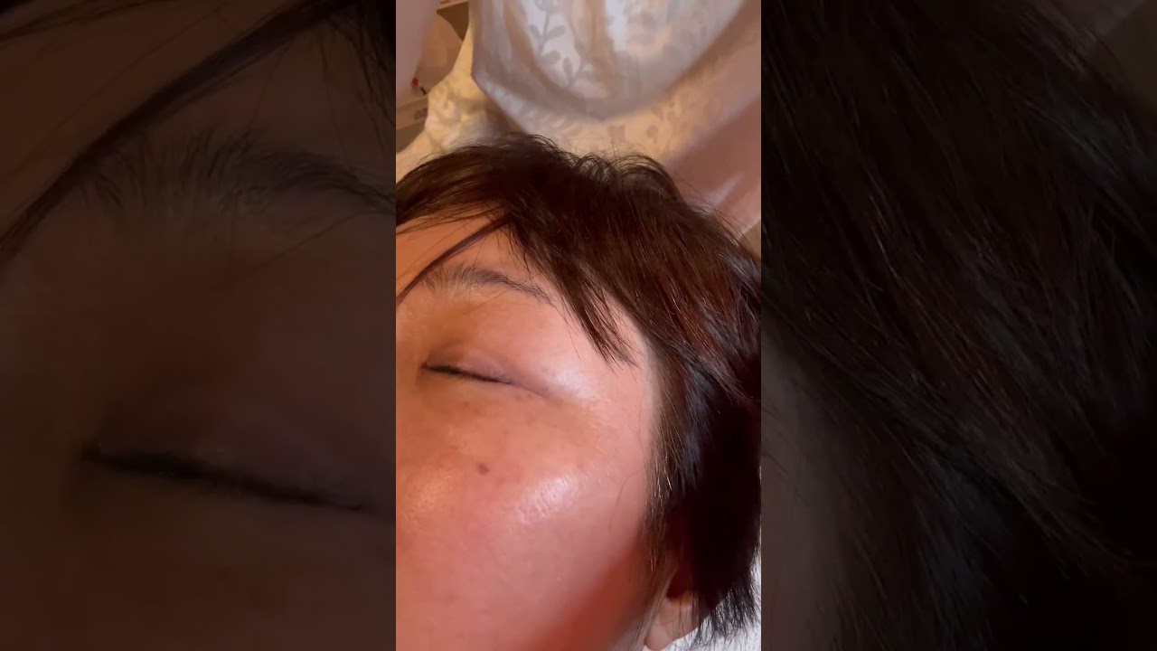 シミ取りケア機器 PURE RADIANCE シミ取りケア機器 PURE RADIANCE シミケアマシン | 美容機器