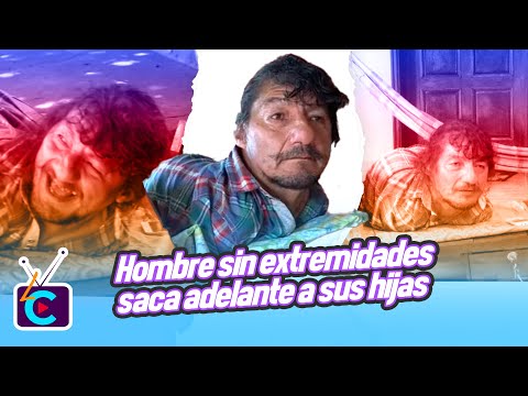 Hombre sin extremidades saca adelante a sus hijas tras abandono de la madre