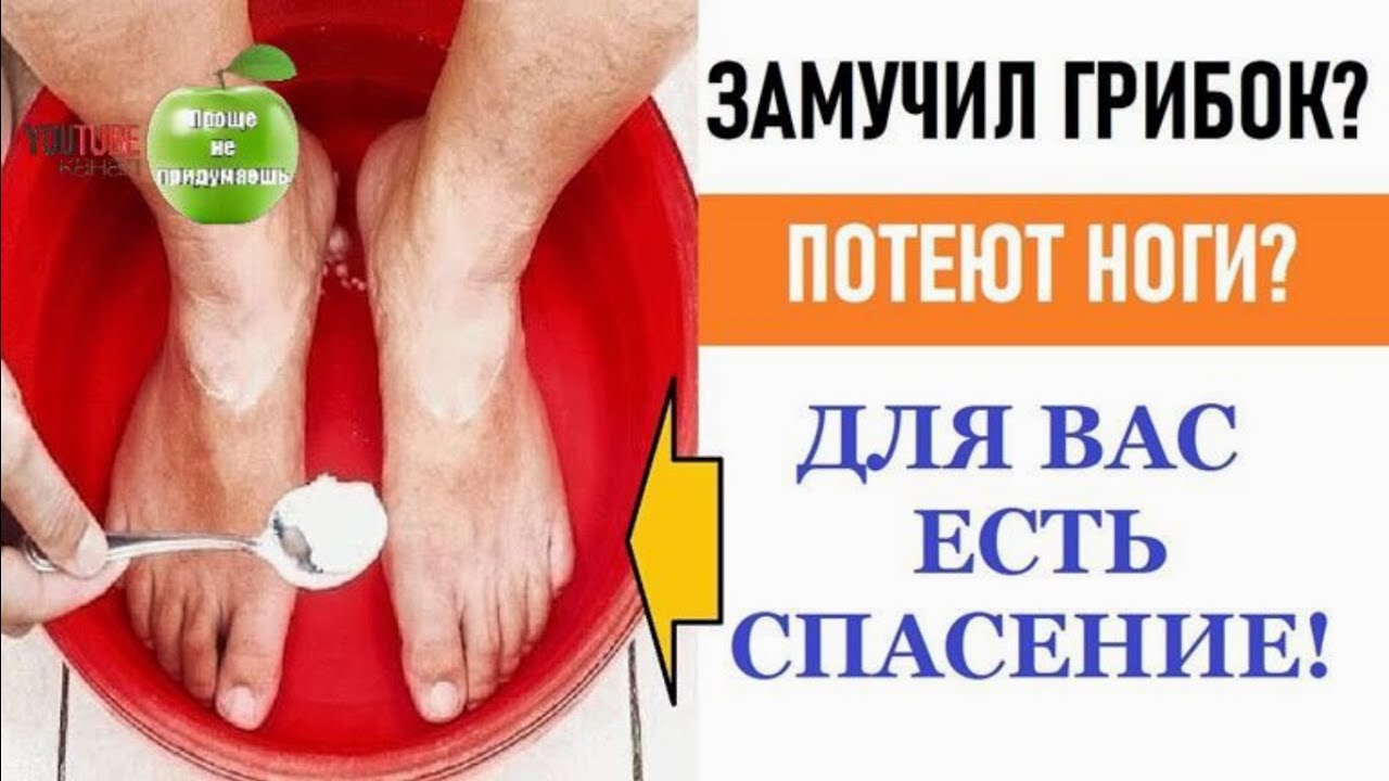 Сильно потеют ноги что делать у женщины