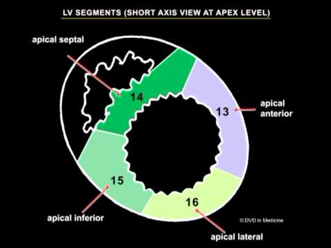 Echocardiographic Assesment of Left Ventricular Systolic Function - YouTube