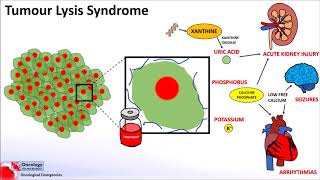 Tumour Lysis Syndrome