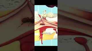 If A Bug Enters Your Ear