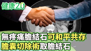 無疼痛膽結石可和平共存 膽囊切除術取膽結石【健康2.0 分段】 @tvbshealth20  EP3025-2  20250517 #鄭凱云#朱光恩#王健宇#陳麗華#宋明樺 無疼痛膽結石可和平共存 膽囊切除術取膽結石【健康2.0 分段】 @tvbshealth20  EP3025-2  20250517 #鄭凱云#朱光恩#王健宇#陳麗華#宋明樺