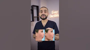علاج بروز الفك بدون جراحة 