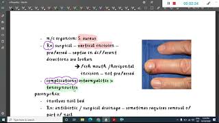 joint and soft tissue infection || Orthopedics screenshot 5