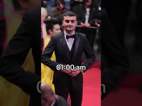 Czn Burak Before After