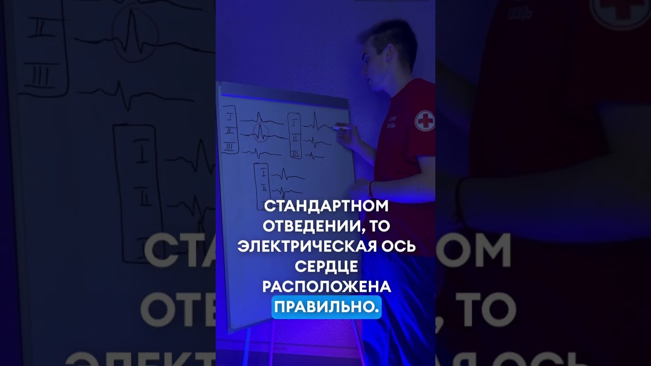Как можно быстро определить положение ЭОС? 