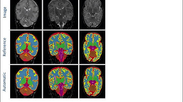 OHBM 2018 | Educational Course | Beyond Linear Decoding: An Introduction to Deep Learning… | Part 5