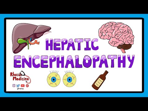 Hepatic Encephalopathy -  Pathophysiology, Stages and West Haven Criteria