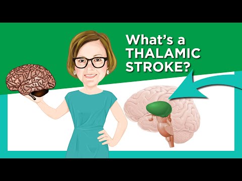 I CARE FOR YOUR BRAIN: Thalamic Stroke