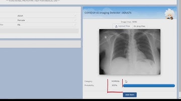 Detect COVID-19 on X-ray images using AI (Einstein Vision).