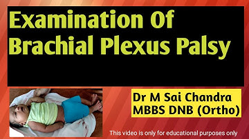 Examination of Brachial Plexus Palsy