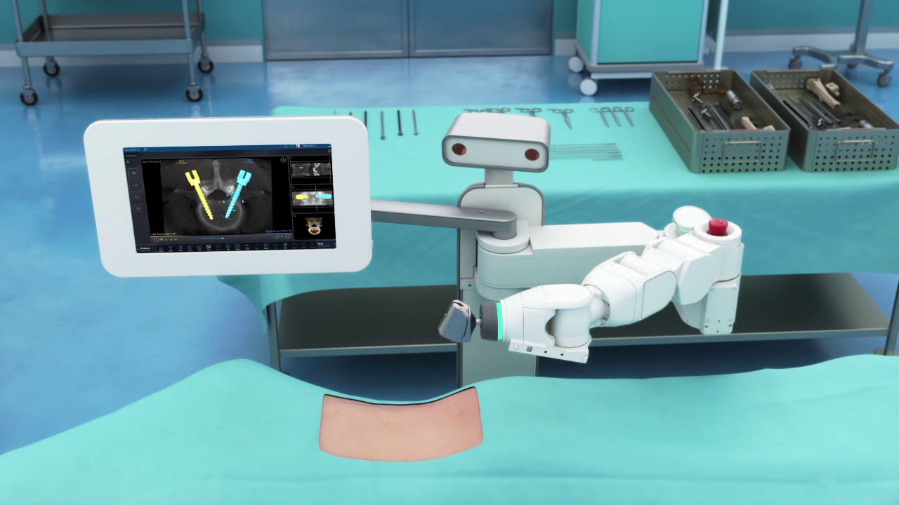 lotus filthy vakuum Mazor X Robotic Spinal Surgical System – Johnson City Medical Center |  Ballad Health