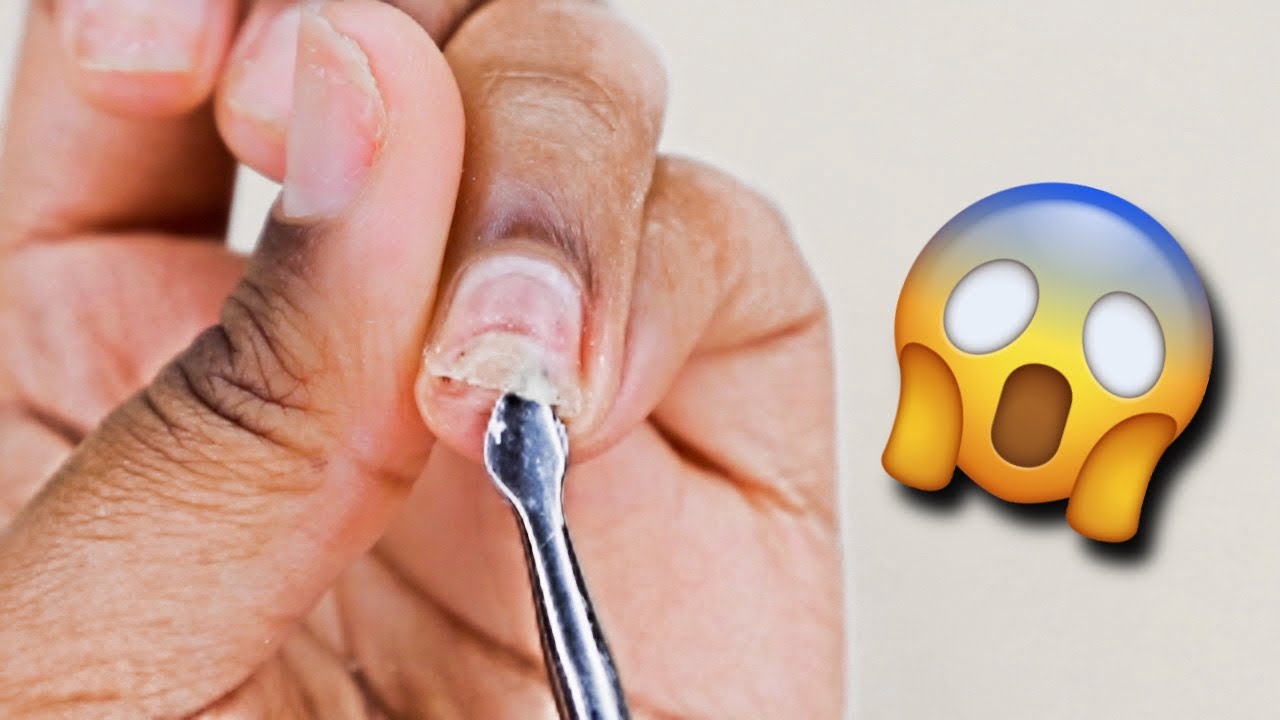 Damaged nails repair 😱 YouTube