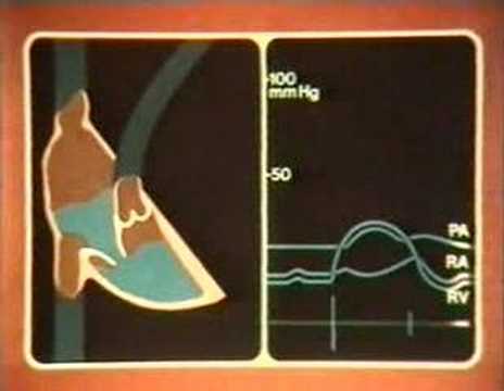 01 - Auskultation und das normale Herz