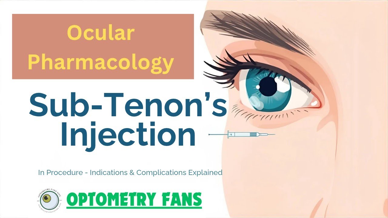 Tenon Injection Sub-Tenon’s Injection in Ophthalmology | Procedure, Indications ...