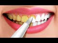 30 Astuces Incroyables Pour Des Dents Bien Blanches || Astuces Et Conseils Beauté