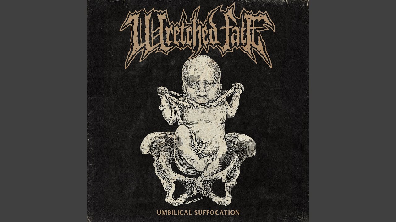 Watch Umbilical Suffocation on YouTube Watch Umbilical Suffocation on YouTube