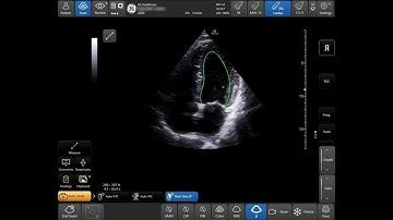 Venue™ Family R3 Tutorial - Real-Time EF