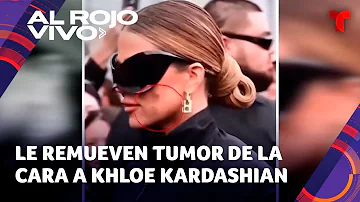 ¿Qué se quitó Khloe de la cara?