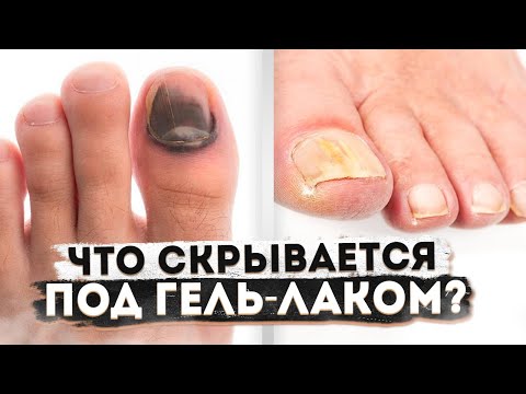 ПОЧЕМУ НУЖНО ОТКАЗАТЬСЯ ОТ ГЕЛЬ-ЛАКА? МНЕНИЕ ПОДОЛОГА