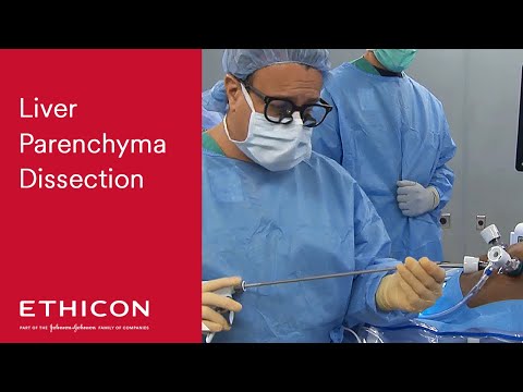 Video: Diffuse Changes In The Liver Parenchyma