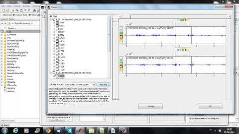 EMG Signal Processing GUI (MATLAB + B-TK)
