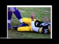 Suh steps on  aaron rodgers leg   on purpose dirty fcking team packers vs lions