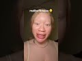 Tiktokdrama Tiktok Fitnessinfluencer Shorts