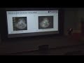 Functional Genomics of Birth Defects