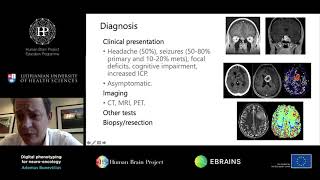 Bunevicius Adomas - Digital phenotyping for neuro-oncology