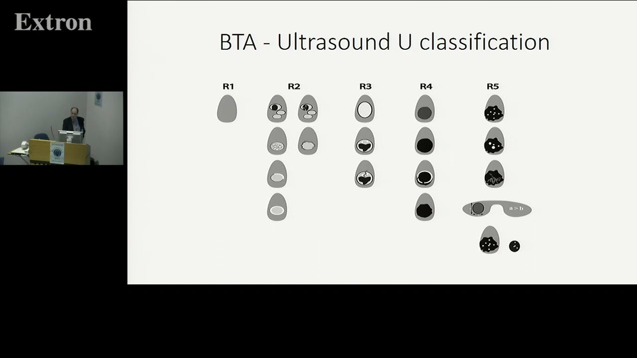 Evaluation and Management of Thyroid Nodules