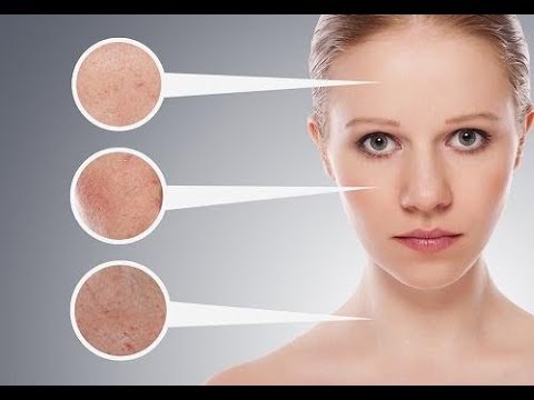 Video: 3 manieren om het Fitzpatrick-huidtype te bepalen