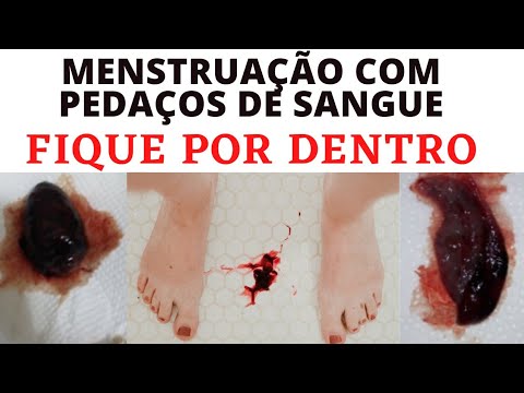 menstruação