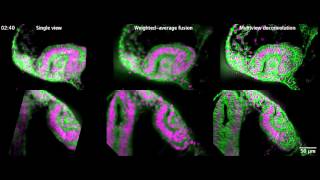 Light sheet imaging: zebrafish optic cup morphogenesis