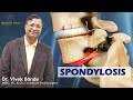 Spondylosis  spondylosis treatments  by dr vivek bonde  consultant neurosurgeon  healthfirst