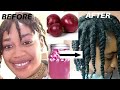 3 WAYS To USE ONION JUICE  For EXTREME HAIR GROWTH|HOW TO USE RED ONION FOR MASSIVE HAIR GROWTH|