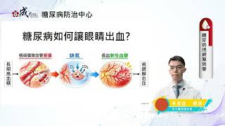 【 糖尿病視網膜病變】李昱逵醫師_成大醫院