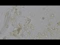 Bacterial feeder 3 of 3