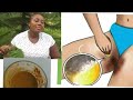 HOW TO LIGHTEN DARK INNER THIGHS IN JUST 3 Days / Clear Dark thigh Fast / DIY