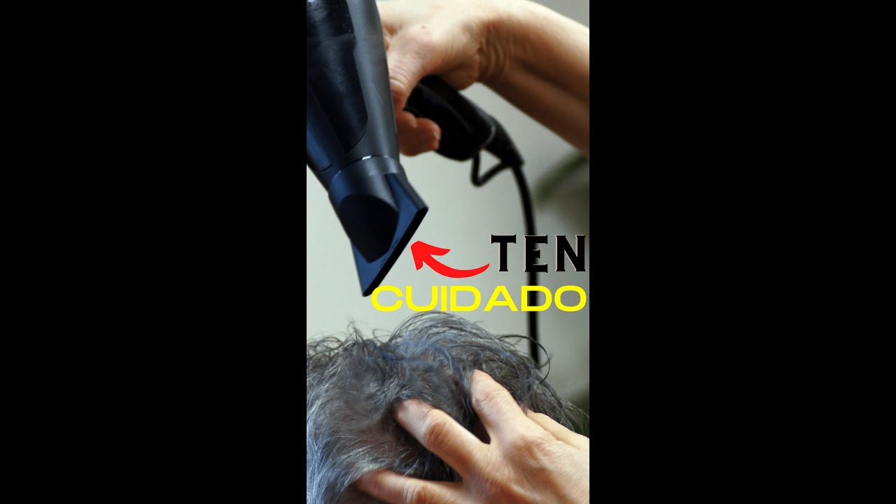 Utilizar La Secadora Te Puede Dejar Calvo o Pelon Alopecia.