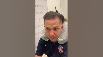 1st session is Scalp Micro-Pigmentation