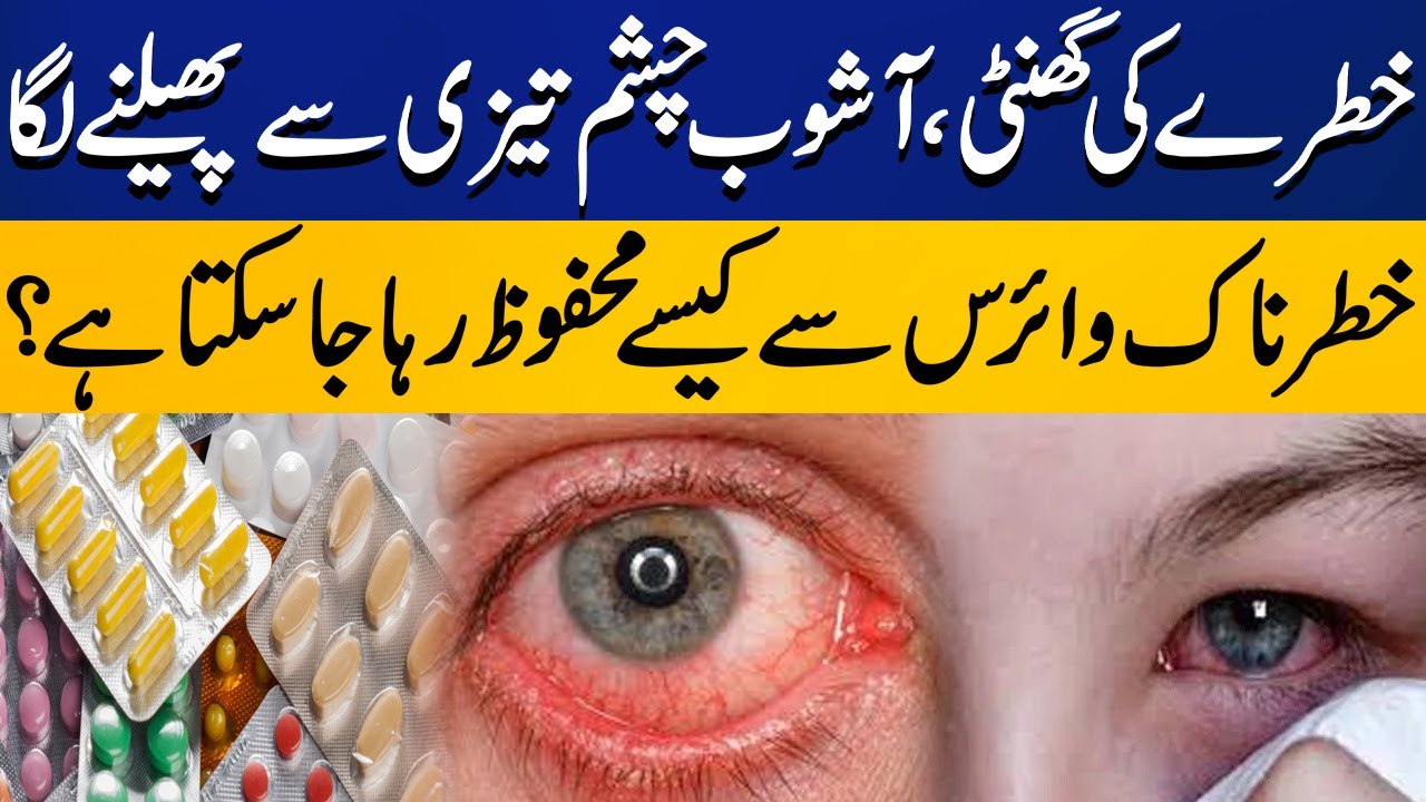 How to Prevent from Eye Infection? Conjunctivitis Epidemic (Ashob E
